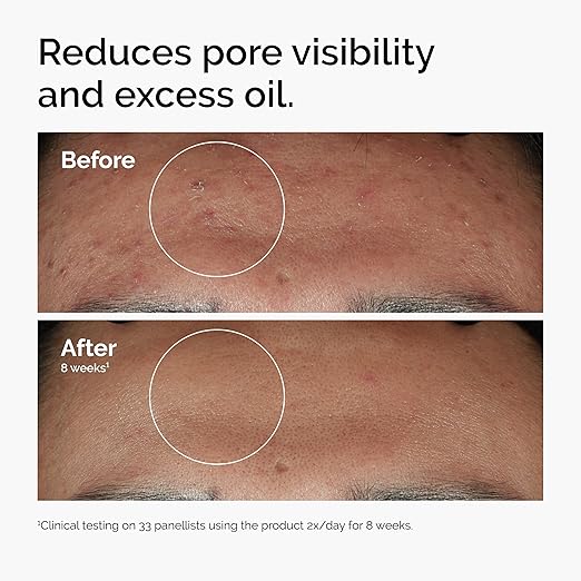 THE ORDINARY Edition Niacinamide 10% + Zinc 1% 30 ml, Clear